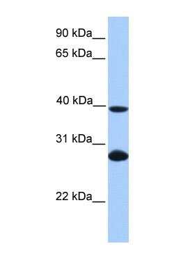 Western Blot: UBE2F/NCE2 Antibody [NBP1-57602]