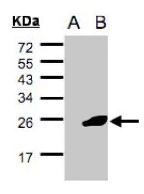 Western Blot: UBE2F/NCE2 Antibody [NBP2-19292]