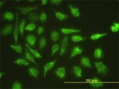 Immunocytochemistry/ Immunofluorescence: UBE2G1 Antibody (1C12-1B2) [H00007326-M01]