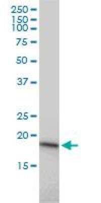 Western Blot: UBE2G1 Antibody (1C12-1B2) [H00007326-M01]