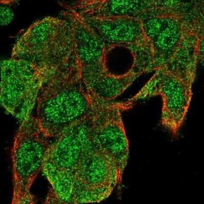Immunocytochemistry/ Immunofluorescence: UBE2G1 Antibody [NBP2-13500]