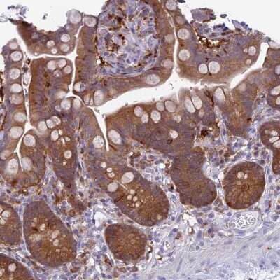 Immunohistochemistry-Paraffin: UBE2G1 Antibody [NBP2-13499]