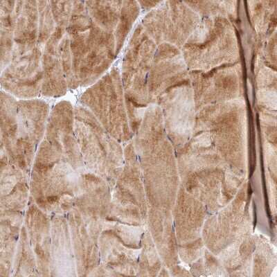 Immunohistochemistry-Paraffin: UBE2G1 Antibody [NBP2-13500]