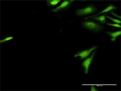 Immunocytochemistry/ Immunofluorescence: UBE2G2 Antibody [H00007327-D01P]