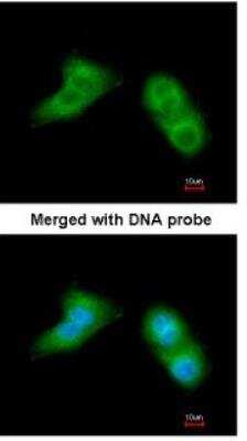 Immunocytochemistry/ Immunofluorescence: UBE2G2 Antibody [NBP1-32729]