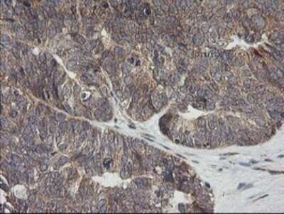 Immunohistochemistry: UBE2G2 Antibody (OTI1B10) - Azide and BSA Free [NBP2-74746]
