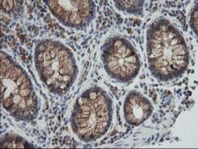 Immunohistochemistry: UBE2G2 Antibody (OTI1B10) - Azide and BSA Free [NBP2-74746]