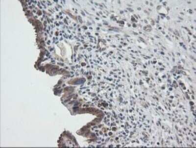 Immunohistochemistry: UBE2G2 Antibody (OTI1B10) - Azide and BSA Free [NBP2-74746]