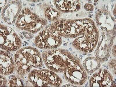 Immunohistochemistry: UBE2G2 Antibody (OTI1B10) - Azide and BSA Free [NBP2-74746]