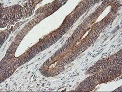 Immunohistochemistry: UBE2G2 Antibody (OTI1B10) [NBP2-46278]