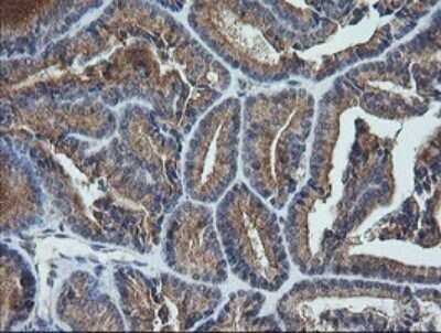 Immunohistochemistry: UBE2G2 Antibody (OTI1B10) [NBP2-46278]