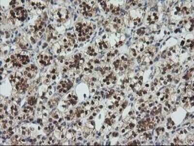 Immunohistochemistry: UBE2G2 Antibody (OTI1B10) [NBP2-46278]