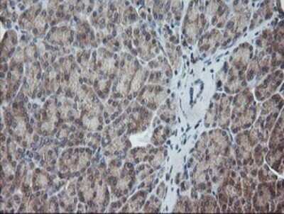 Immunohistochemistry: UBE2G2 Antibody (OTI1B10) [NBP2-46278]