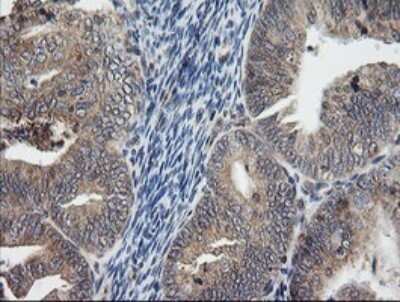 Immunohistochemistry: UBE2G2 Antibody (OTI1B10) [NBP2-46278]