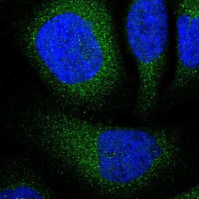 Immunocytochemistry/ Immunofluorescence: UBE2I/Ubc9 Antibody [NBP1-86887]