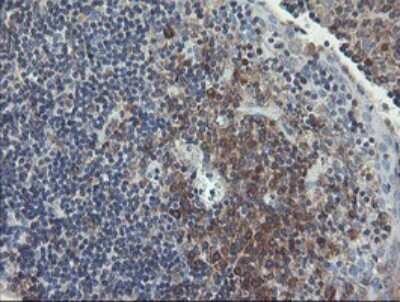 Immunohistochemistry: UBE2J1 Antibody (OTI3D1) [NBP2-45402]