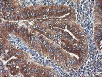 Immunohistochemistry: UBE2J1 Antibody (OTI3D1) [NBP2-45402]