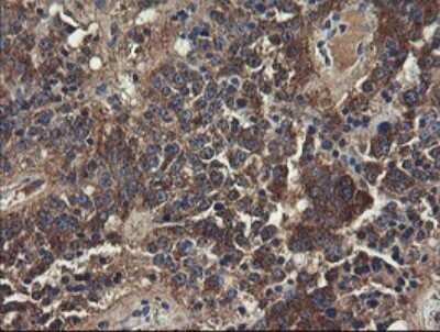 Immunohistochemistry: UBE2J1 Antibody (OTI3D1) [NBP2-45402]