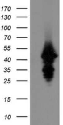 Western Blot: UBE2J1 Antibody (OTI3D1) [NBP2-45402]