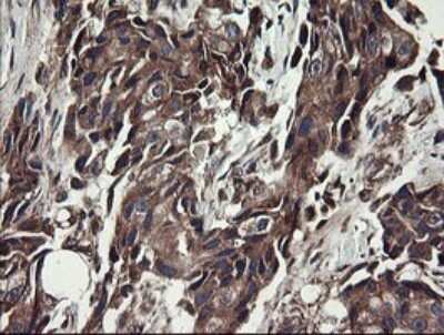 Immunohistochemistry: UBE2J1 Antibody (OTI3D1) - Azide and BSA Free [NBP2-74747]