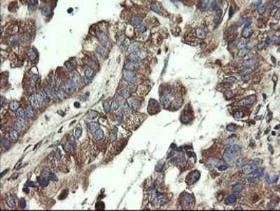 Immunohistochemistry: UBE2J1 Antibody (OTI3D1) - Azide and BSA Free [NBP2-74747]