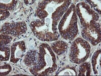 Immunohistochemistry: UBE2J1 Antibody (OTI3D1) - Azide and BSA Free [NBP2-74747]