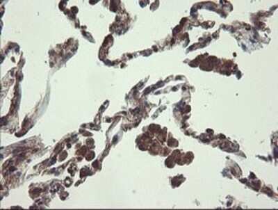 Immunohistochemistry: UBE2J1 Antibody (OTI3D1) - Azide and BSA Free [NBP2-74747]