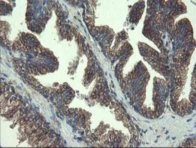 Immunohistochemistry: UBE2J1 Antibody (OTI3D1) - Azide and BSA Free [NBP2-74747]