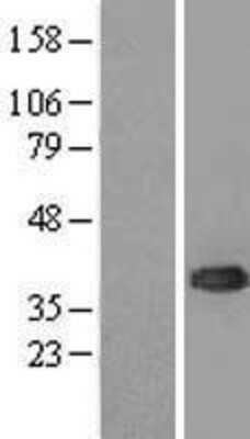 Western Blot: UBE2J1 Overexpression Lysate [NBL1-17534]