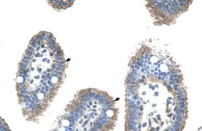 Immunohistochemistry-Paraffin: UBE2J2/UBC6 Antibody [NBP1-59760]