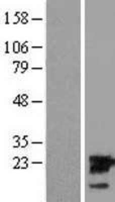 Western Blot: UBE2M/Ubc12 Overexpression Lysate [NBL1-17540]