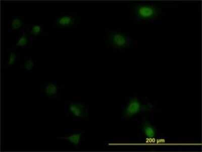 Immunocytochemistry/ Immunofluorescence: UBE2M/Ubc12 Antibody (3C4) [H00009040-M01]