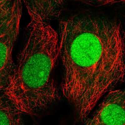 Immunocytochemistry/ Immunofluorescence: UBE2M/Ubc12 Antibody [NBP2-49268]