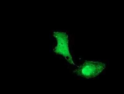 Immunocytochemistry/ Immunofluorescence: UBE2M/Ubc12 Antibody (OTI2D9) - Azide and BSA Free [NBP2-74748]