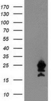 Western Blot: UBE2M/Ubc12 Antibody (OTI2D9)Azide and BSA Free [NBP2-74748]