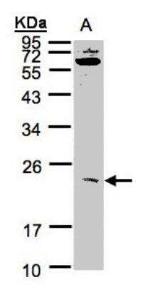 Western Blot: UBE2M/Ubc12 Antibody [NBP1-31459]