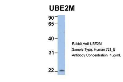 Western Blot: UBE2M/Ubc12 Antibody [NBP1-55035]