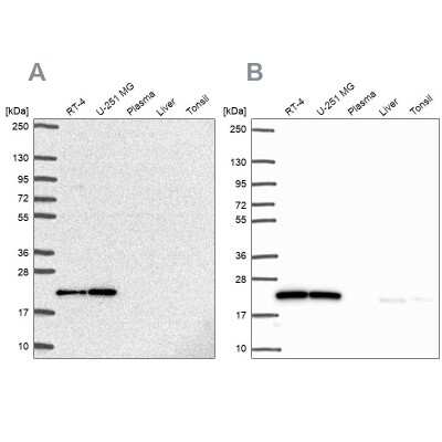 Western Blot: UBE2M/Ubc12 Antibody [NBP2-49137]