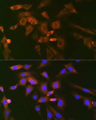 Immunocytochemistry/ Immunofluorescence: UBE2N/Ubc13 Antibody (10O9Z5) [NBP3-16793]
