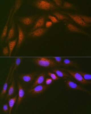 Immunocytochemistry/ Immunofluorescence: UBE2N/Ubc13 Antibody (10O9Z5) [NBP3-16793]