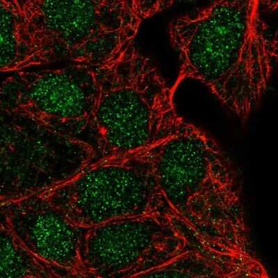 Immunocytochemistry/ Immunofluorescence: UBE2N/Ubc13 Antibody [NBP2-48823]