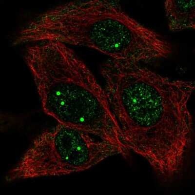 Immunocytochemistry/ Immunofluorescence: UBE2O Antibody [NBP2-13501]