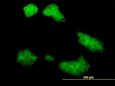 Immunocytochemistry/ Immunofluorescence: UBE2Q2 Antibody (2H3) [H00092912-M04]