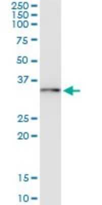 Immunoprecipitation: UBE2R2 Antibody (5E7) [H00054926-M01]