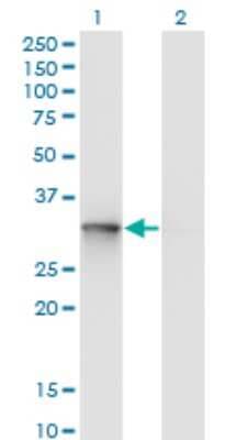 Western Blot: UBE2R2 Antibody (5E7) [H00054926-M01]