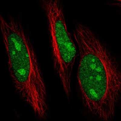 Immunocytochemistry/ Immunofluorescence: UBE2R2 Antibody [NBP2-57527]
