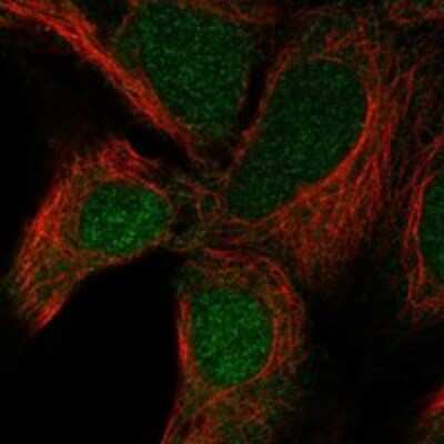 Immunocytochemistry/ Immunofluorescence: UBE2R2 Antibody [NBP3-17955]