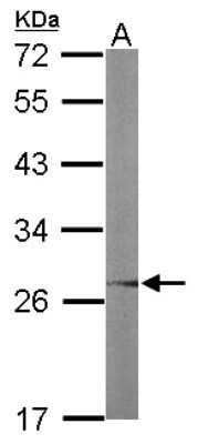 Western Blot: UBE2R2 Antibody [NBP2-15154]