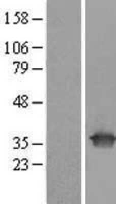 Western Blot: UBE2R2 Overexpression Lysate [NBL1-17543]
