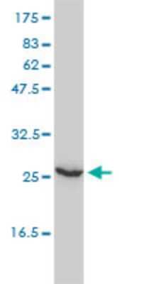 Western Blot: UBE2T Antibody (1E12-4A3) [H00029089-M01]